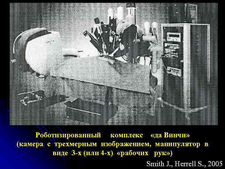 Роботизированный комплекс «да Винчи» (камера с трехмерным изображением, манипулятор в виде 3 -х (или