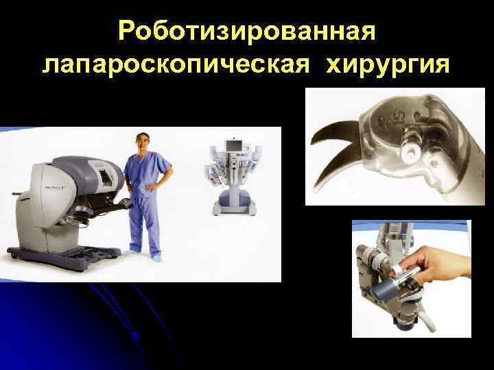 Роботизированная лапароскопическая хирургия 