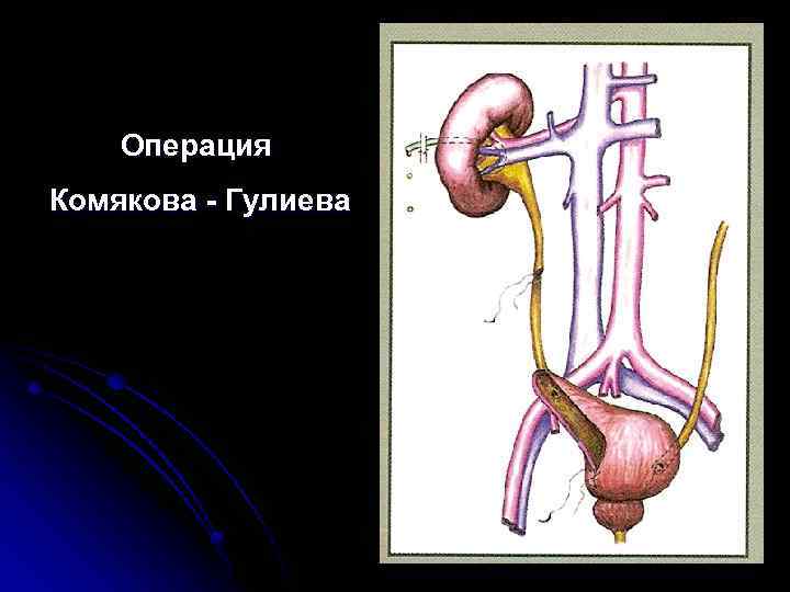 Операция Комякова - Гулиева 