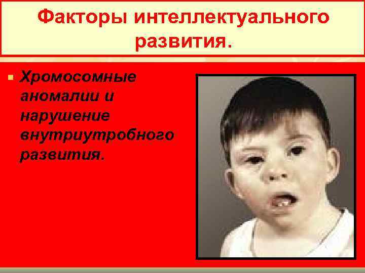 Факторы интеллектуального развития. Хромосомные аномалии и нарушение внутриутробного развития. 