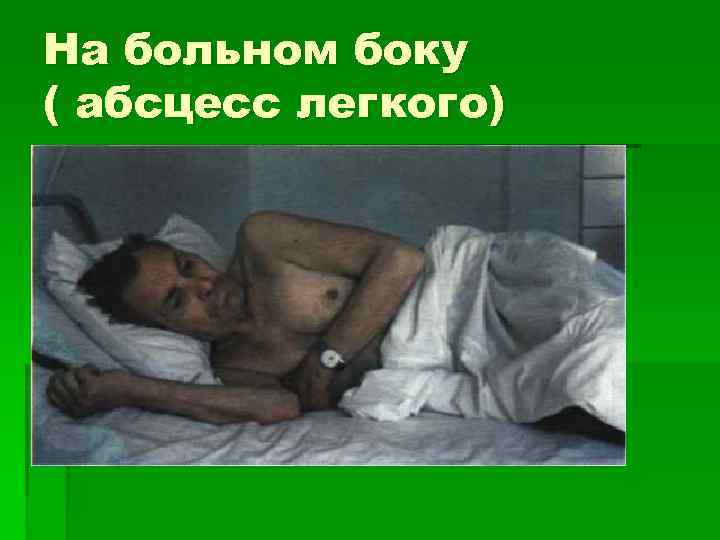 На больном боку ( абсцесс легкого) 