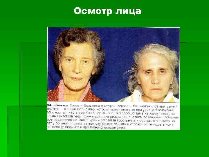 Осмотр лица 