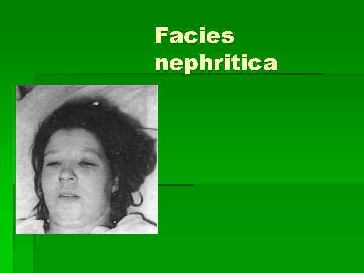 Facies nephritica 