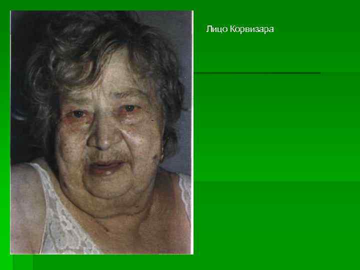 Лицо Корвизара 