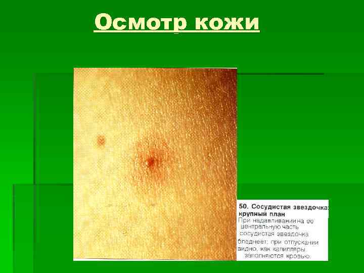 Осмотр кожи 