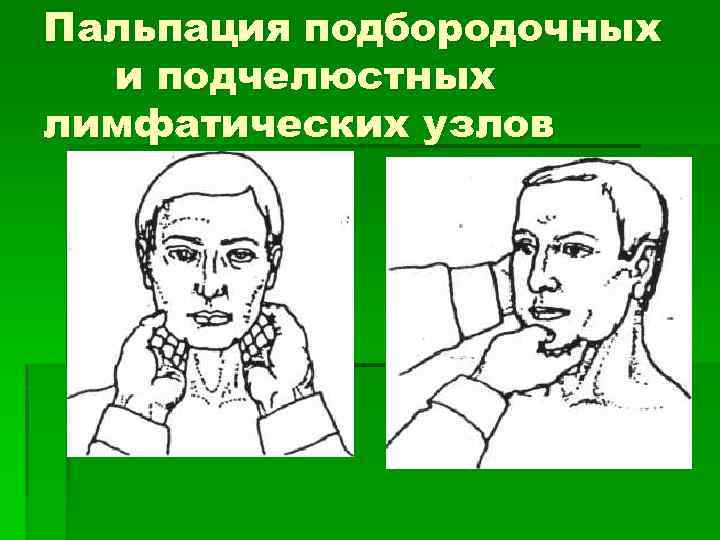 Пальпация подбородочных и подчелюстных лимфатических узлов 