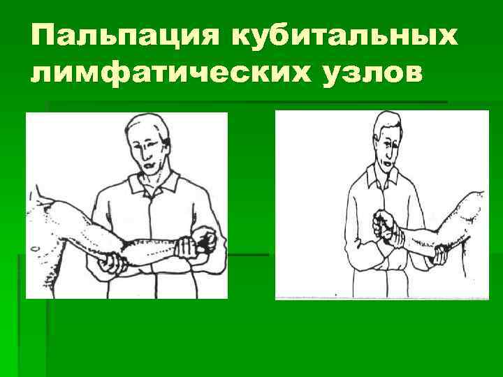 Пальпация кубитальных лимфатических узлов 