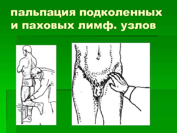 пальпация подколенных и паховых лимф. узлов 