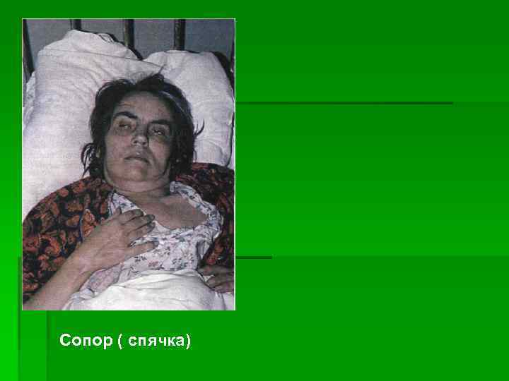 Сопор ( спячка) 