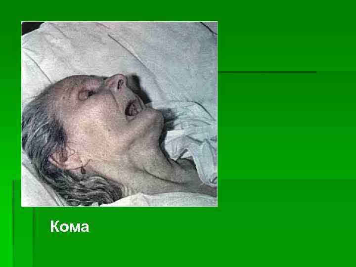 Кома 