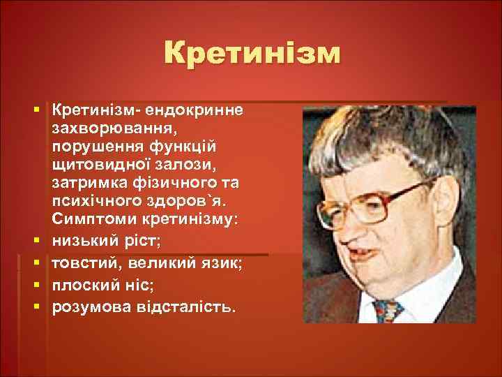 Кретинізм § Кретинізм- ендокринне захворювання, порушення функцій щитовидної залози, затримка фізичного та психічного здоров`я.