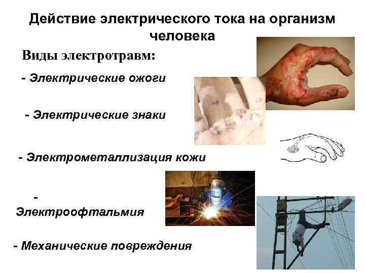Действие электрического тока на организм человека Виды электротравм: - Электрические ожоги - Электрические знаки