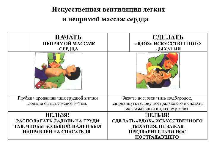Искусственная вентиляция легких и непрямой массаж сердца 