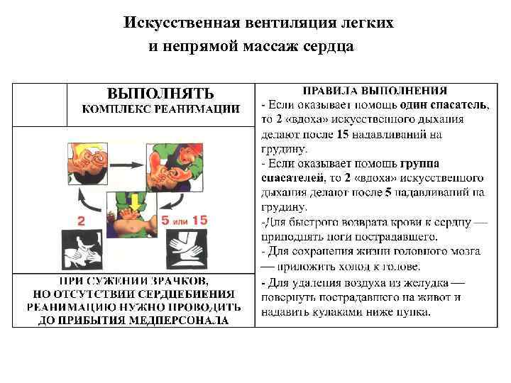Искусственная вентиляция легких и непрямой массаж сердца 