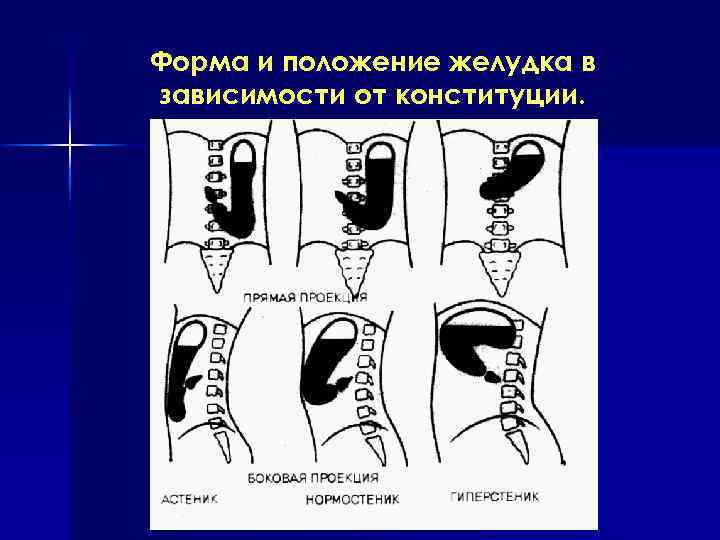 Положение желудка. Формы и положения желудка. Формы и положение желудка в зависимости от Конституции. Желудок гиперстеника форма.