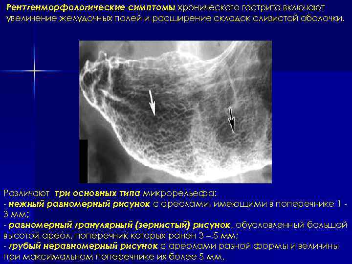 Диагностическое значение визуальной эндоскопической картины при заболеваниях желудка и кишечника