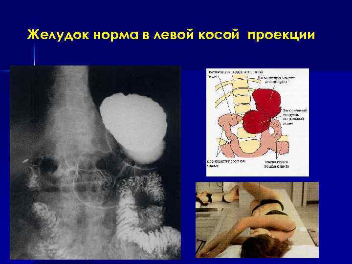 Желудок в норме