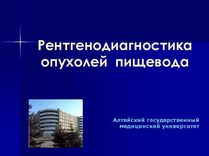Рентгенодиагностика опухолей пищевода Алтайский государственный медицинский университет 