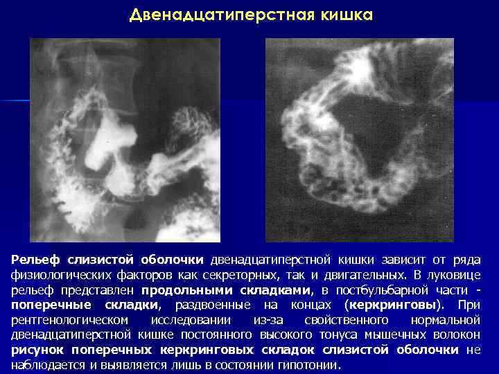 Рентгеноанатомия жкт презентация