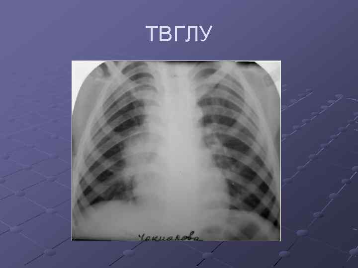ТВГЛУ 