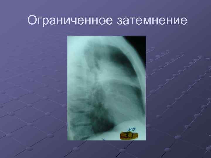 Ограниченное затемнение 