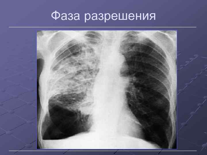 Фаза разрешения 