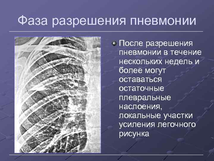Фаза разрешения пневмонии После разрешения пневмонии в течение нескольких недель и более могут оставаться