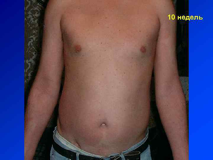 10 недель 