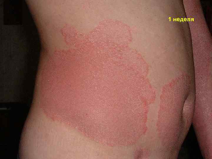 1 неделя 