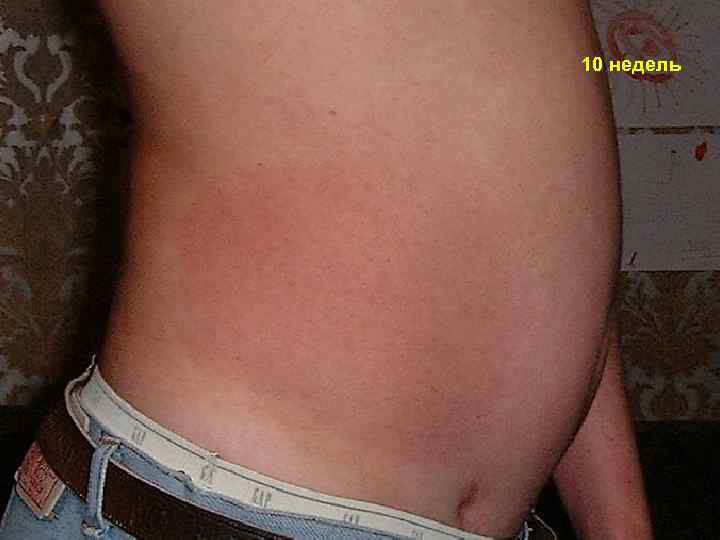10 недель 