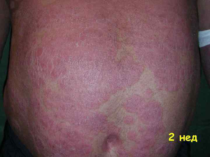 2 нед 