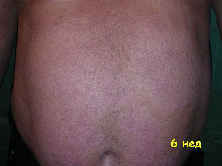 6 нед 