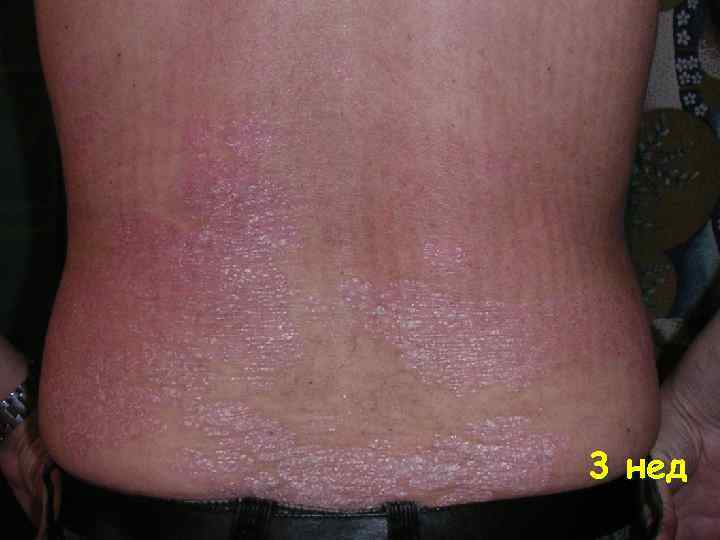 3 нед 