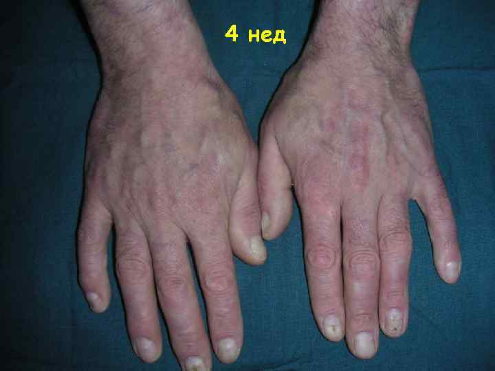 4 нед 