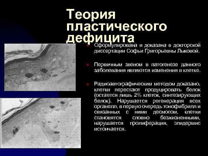 Теория пластического дефицита n n n Сформулирована и доказана в докторской диссертации Софьи Григорьевны