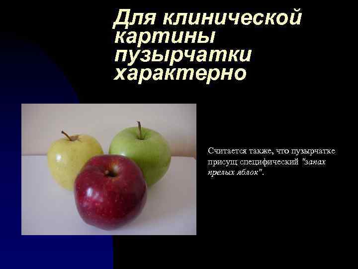Для клинической картины пузырчатки характерно Считается также, что пузырчатке присущ специфический "запах прелых яблок".