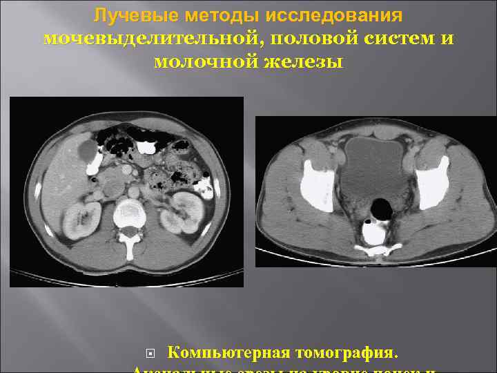 Лучевые методы исследования мочевыделительной, половой систем и молочной железы Компьютерная томография. 
