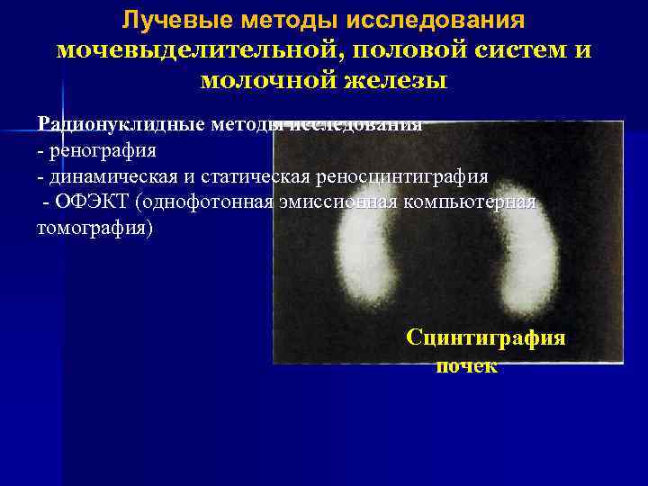 Лучевые методы исследования мочевыделительной, половой систем и молочной железы Радионуклидные методы исследования - ренография
