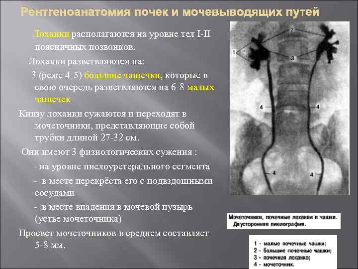 Рентгеноанатомия почек и мочевыводящих путей Лоханки располагаются на уровне тел І-ІІ поясничных позвонков. Лоханки