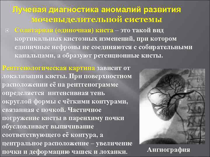 Лучевая диагностика аномалий развития мочевыделительной системы Солитарная (одиночная) киста – это такой вид кортикальных