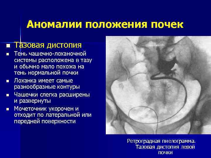 Система как компьютерная помощь в диагностике заболеваний на основе построения