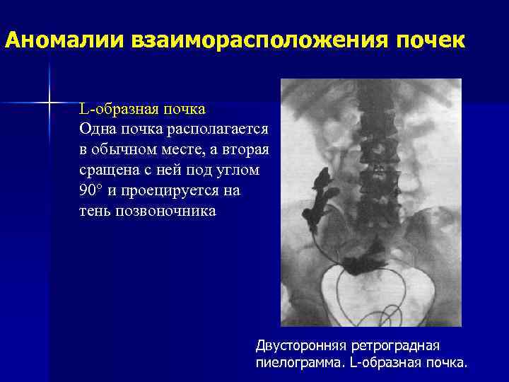 Лучевая диагностика мочевыделительной системы презентация