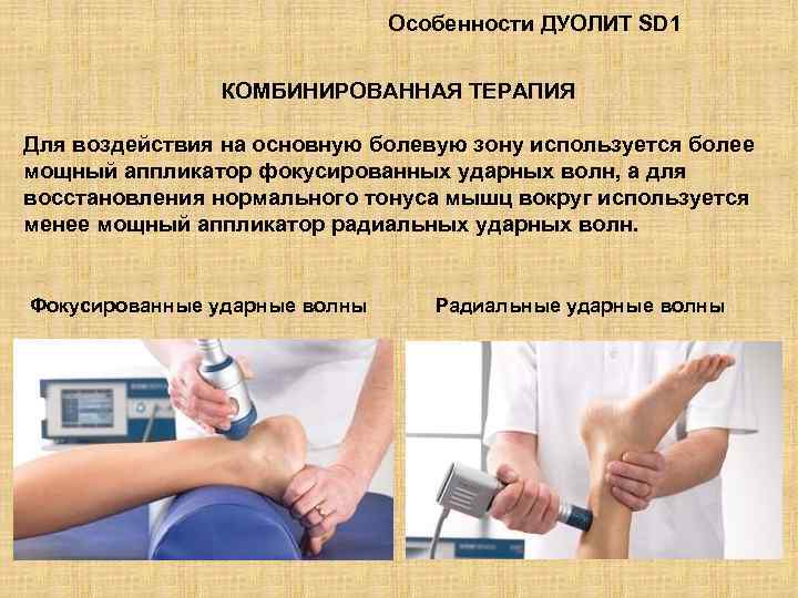 Особенности ДУОЛИТ SD 1 КОМБИНИРОВАННАЯ ТЕРАПИЯ Для воздействия на основную болевую зону используется более