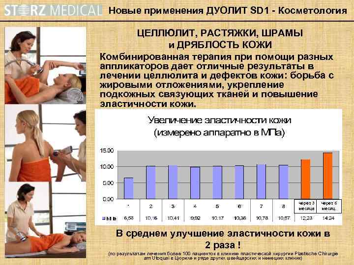 Новые применения ДУОЛИТ SD 1 - Косметология ЦЕЛЛЮЛИТ, РАСТЯЖКИ, ШРАМЫ и ДРЯБЛОСТЬ КОЖИ Комбинированная