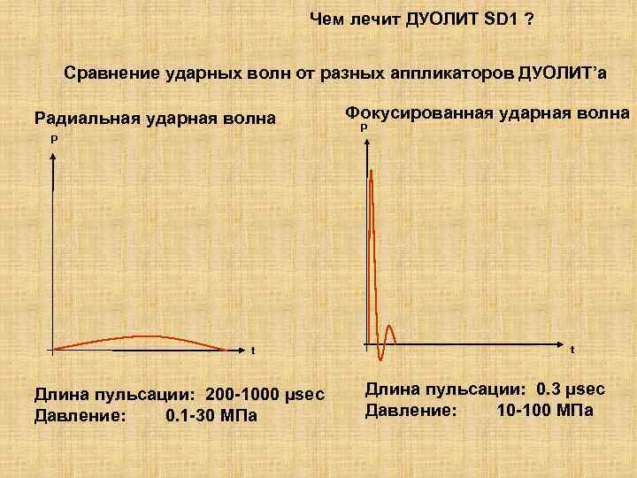 Чем лечит ДУОЛИТ SD 1 ? Сравнение ударных волн от разных аппликаторов ДУОЛИТ’а Радиальная