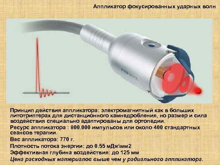 Аппликатор фокусированных ударных волн Принцип действия аппликатора: электромагнитный как в больших литотриптерах для дистанционного