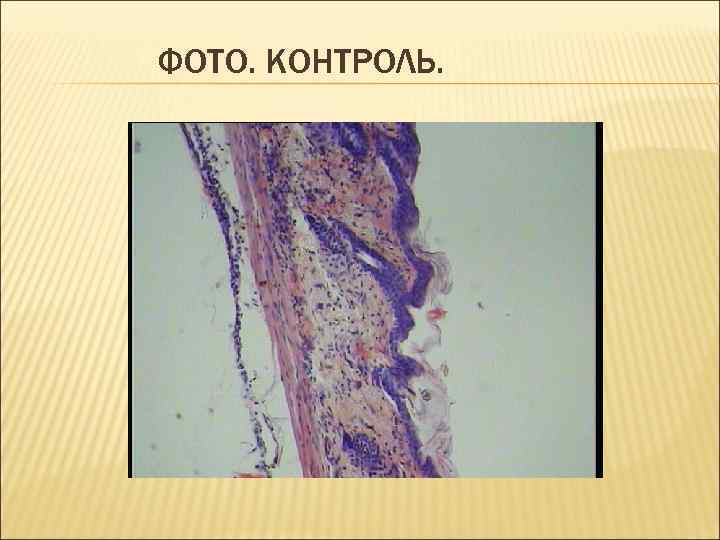 ФОТО. КОНТРОЛЬ. 