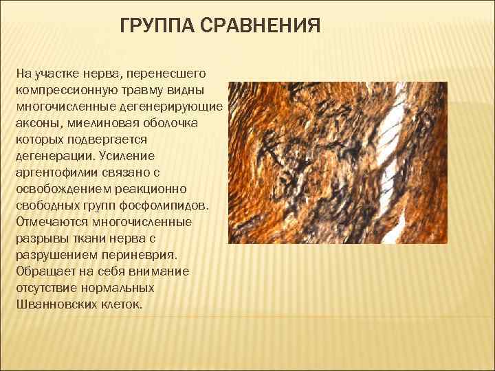 ГРУППА СРАВНЕНИЯ На участке нерва, перенесшего компрессионную травму видны многочисленные дегенерирующие аксоны, миелиновая оболочка