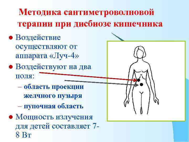 Методика сантиметроволновой терапии при дисбиозе кишечника Воздействие осуществляют от аппарата «Луч-4» l Воздействуют на