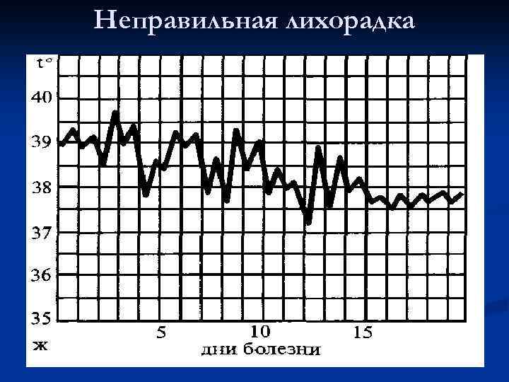 Неправильная лихорадка 